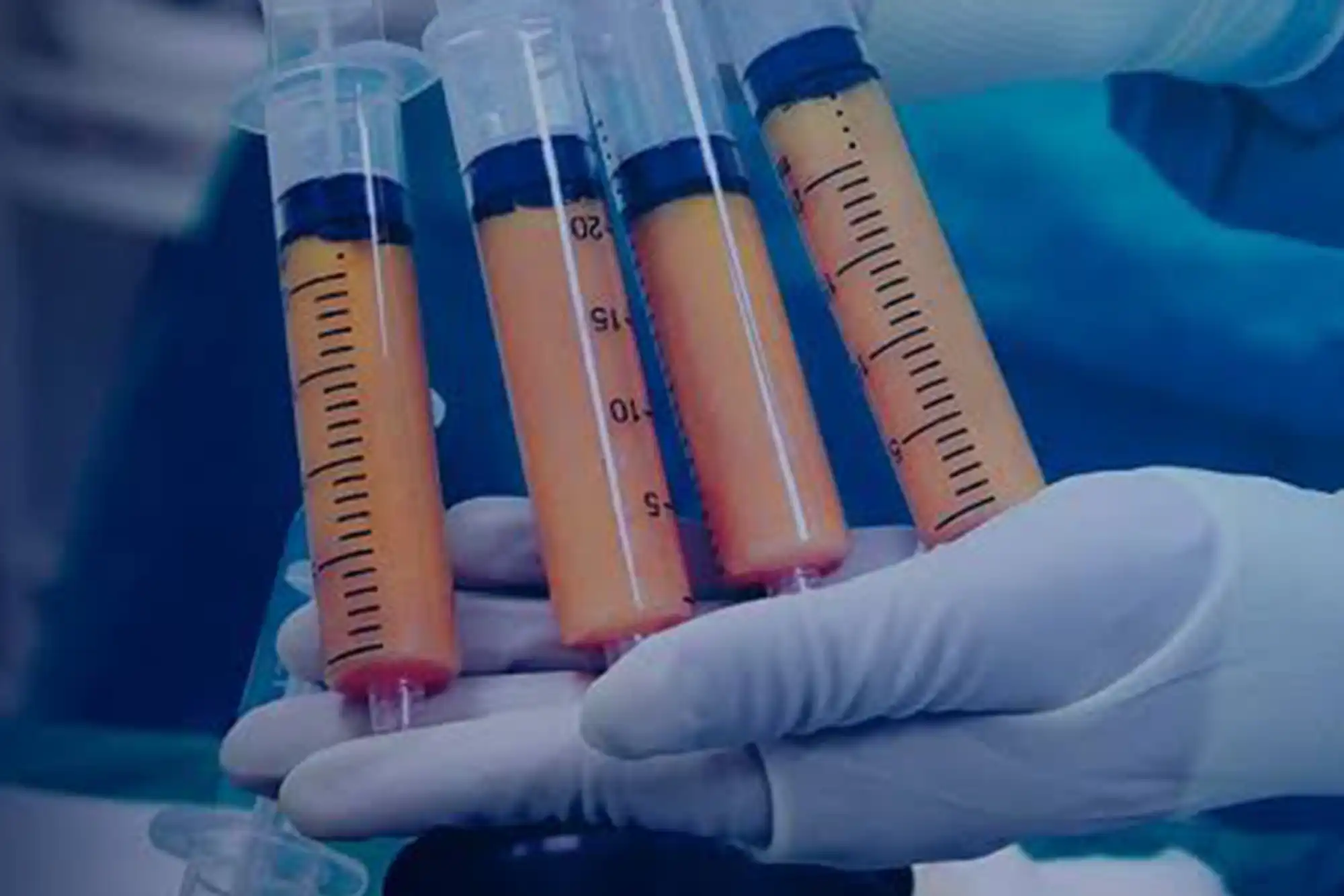 Adipose-Derived MSCs