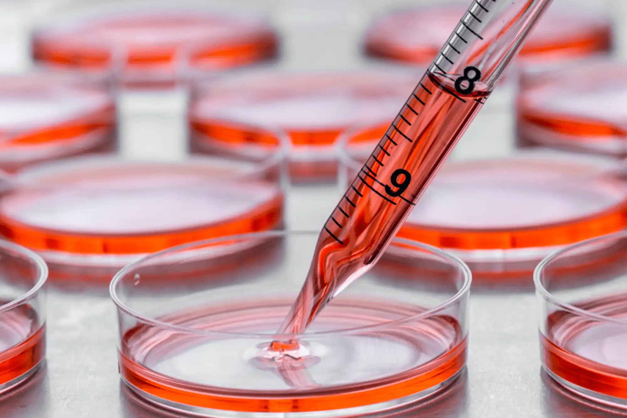 Mesenchymal Stem Cell (MSC) Therapy